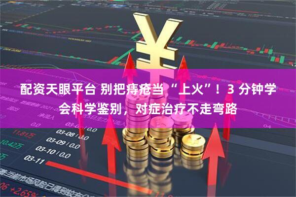 配资天眼平台 别把痔疮当 “上火”！3 分钟学会科学鉴别，对症治疗不走弯路
